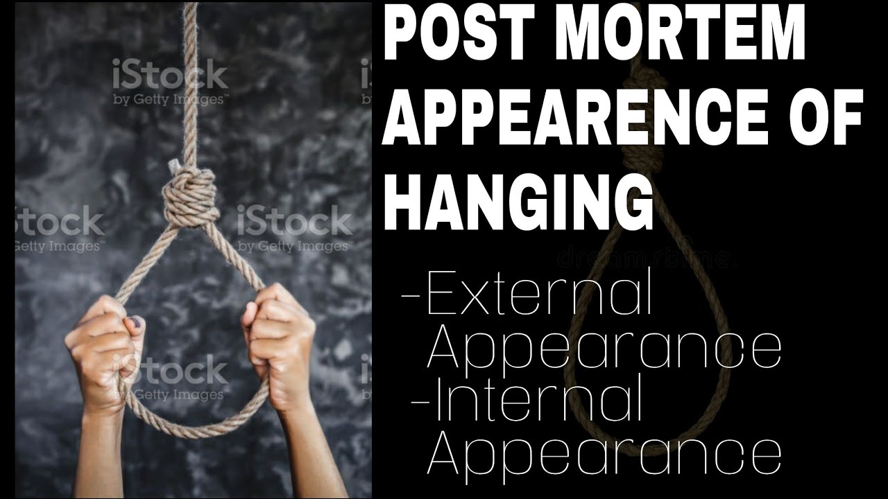 postmortem Appearance of Hanging || External appearance || ligature marks || Part - 1