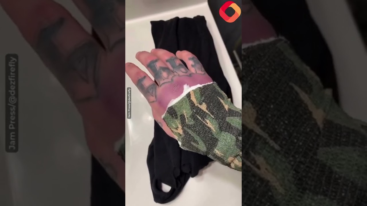 Extreme body modification TikToker spends $10,000 on transformation including PENTAGRAM implanted