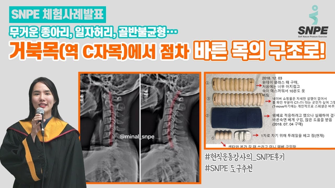 SNPE 현대인의 필수 운동! 거북목, 역C자목에서 점차 바른 목의 구조로! - SNPE 체험사례발표