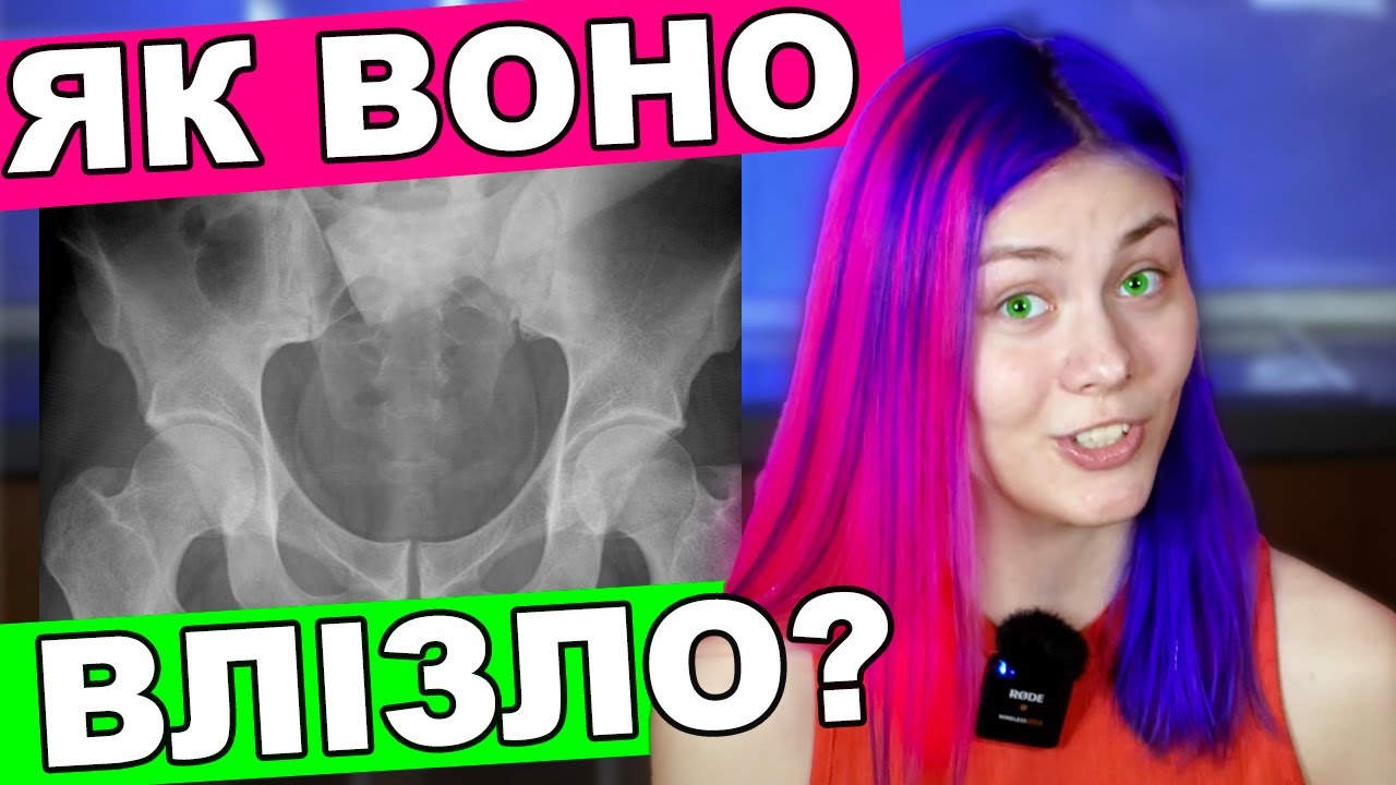 ТОП-5 предметів, які не варто в себе вставляти