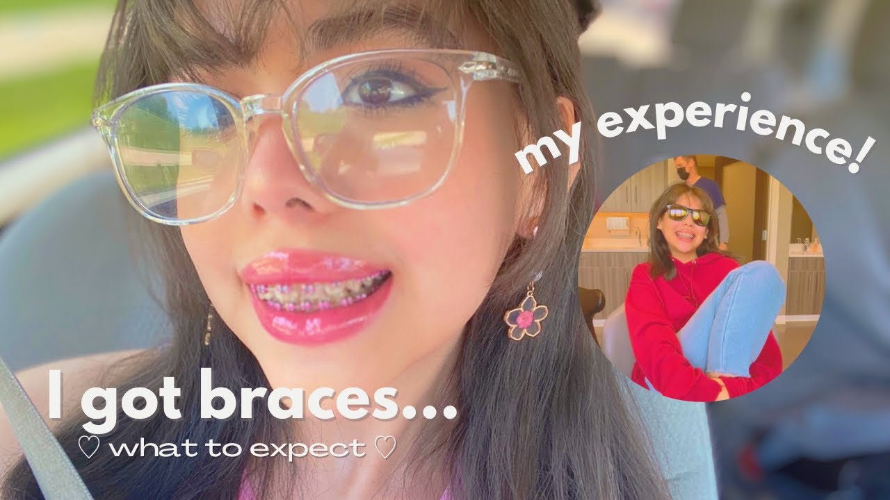 Я НОШУ БРЕКЕТЫ! ♡ (чего ожидать + мой опыт)