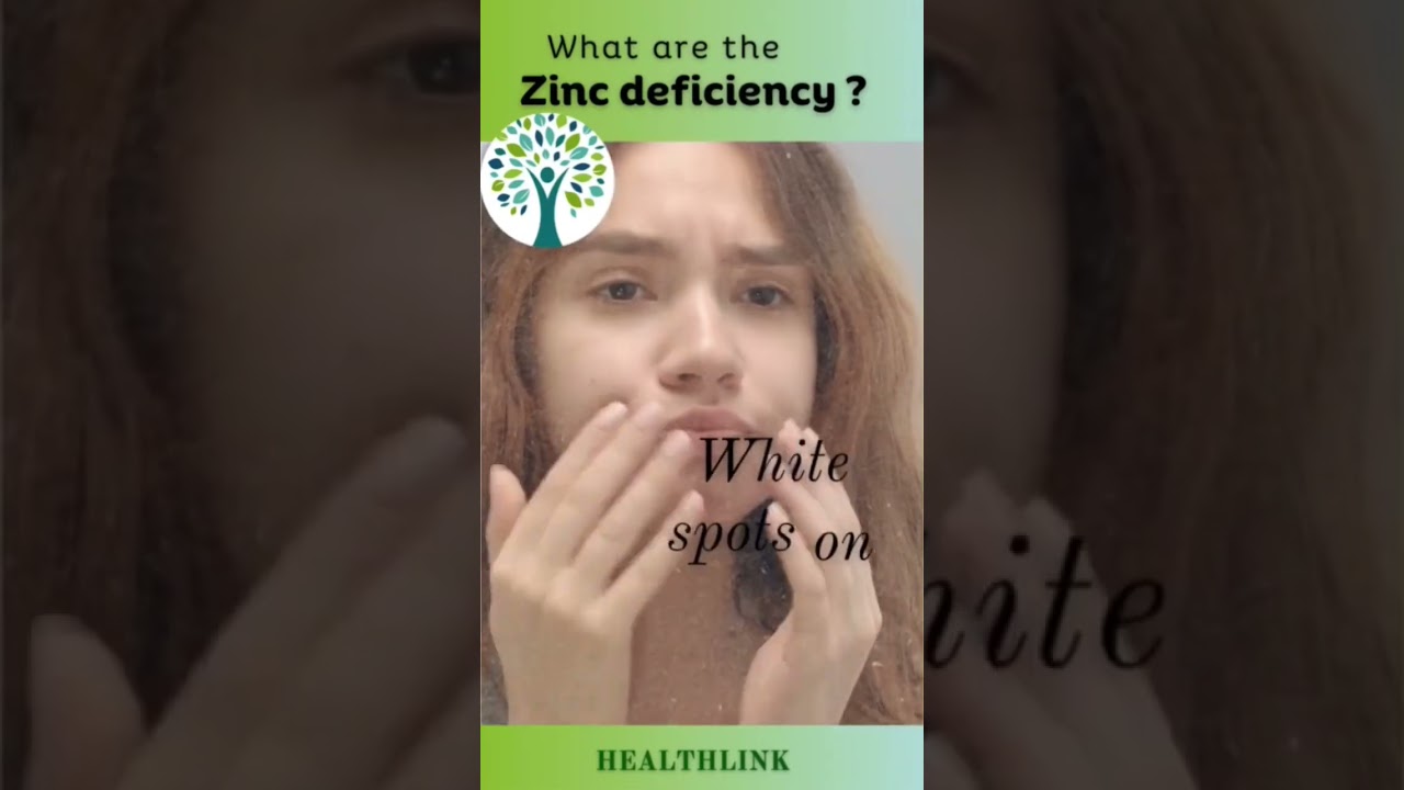 #zinc deficiency #symptoms #afterage60 #healthcare #healthy #healthlive #healthlink