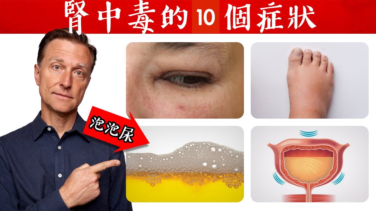 腎中毒的10個症狀,自然療法,柏格醫生 Dr Berg