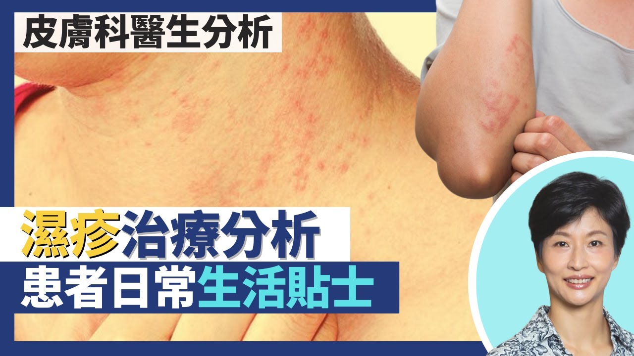 濕疹｜濕疹治療分析拆解類固醇迷思 非類固醇濕疹藥膏非人人適合！生活貼士預防復發 洗澡不用番梘／沐浴露？保濕潤膚膏如何選擇？｜王建芳醫生 皮膚科何景文醫生｜人類健康研究所