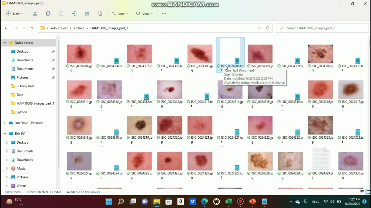 Object Detection Using YOLO v4 on Kaggle Cancer Data Set - Quick Training Guide