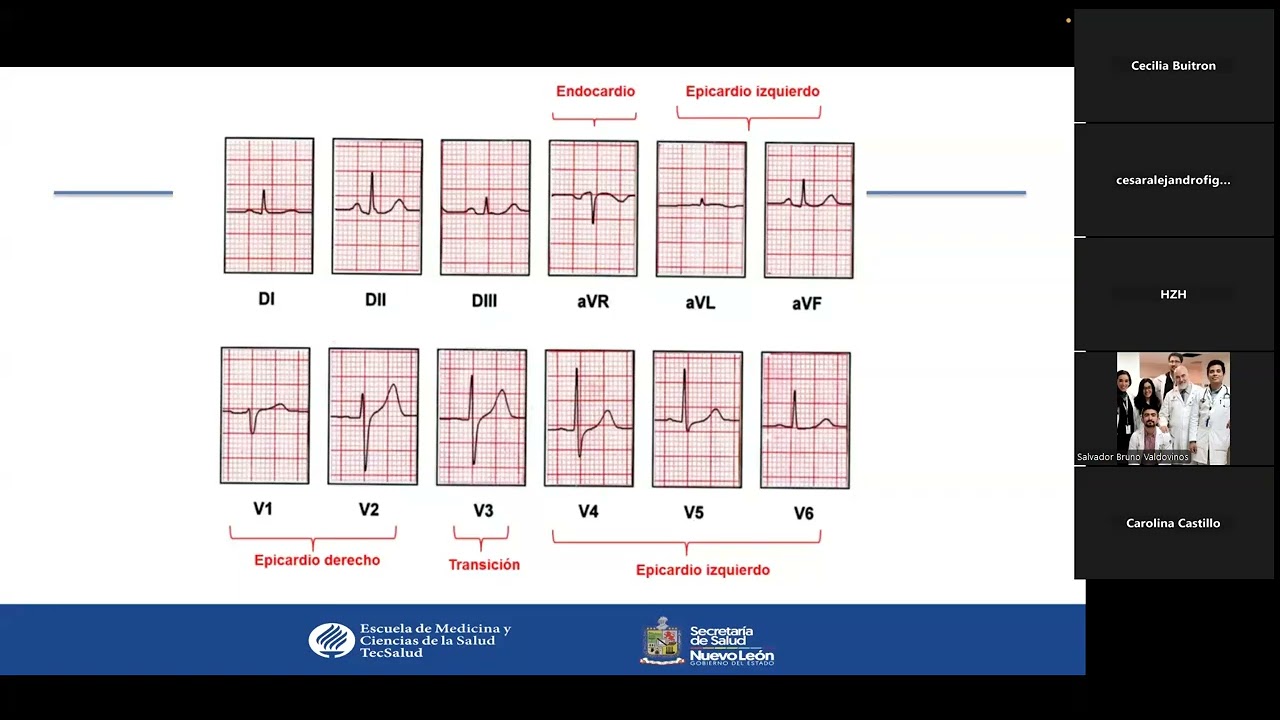 Sesión de experto: Electrocardiograma