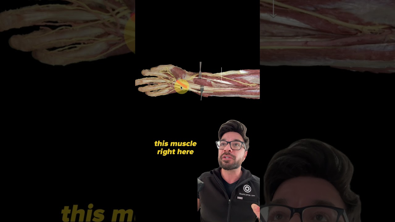 Anatomy of the Forearm | Can you identify this structure? | Med School Bootcamp