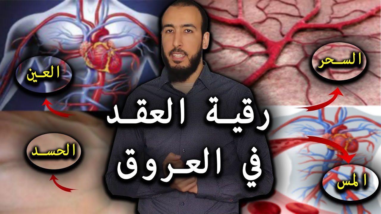 رقية إخراج عقد السحر والمس والعين والحسد المستقرة في العروق والمتسببة في الأمراض والأوجاع والآلام