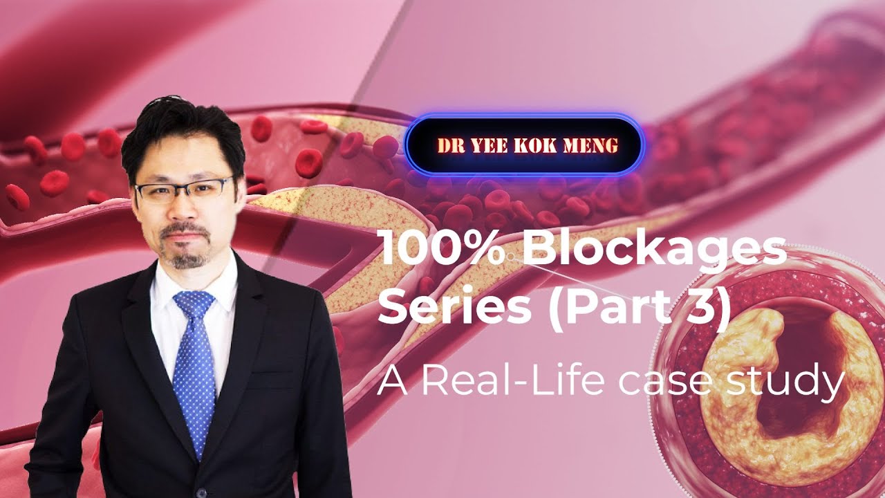 100% Coronary Heart Blockages (Part 3): A Real-Life Case Study
