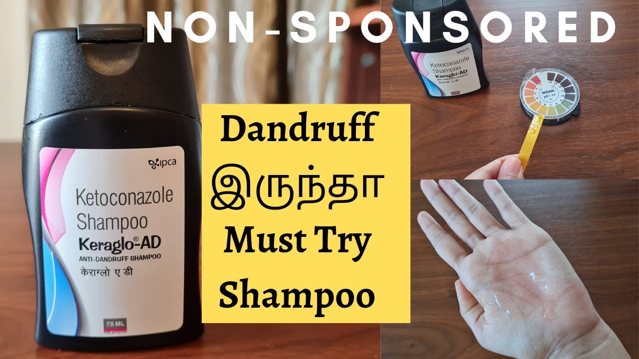 PRODUCT REVIEW(EPI-13)KERAGLO AD ANTI-DANDRUFF SHAMPOO REVIEW| NON SPONSORED|EFFECTIVE&CHEAP|ITCHING