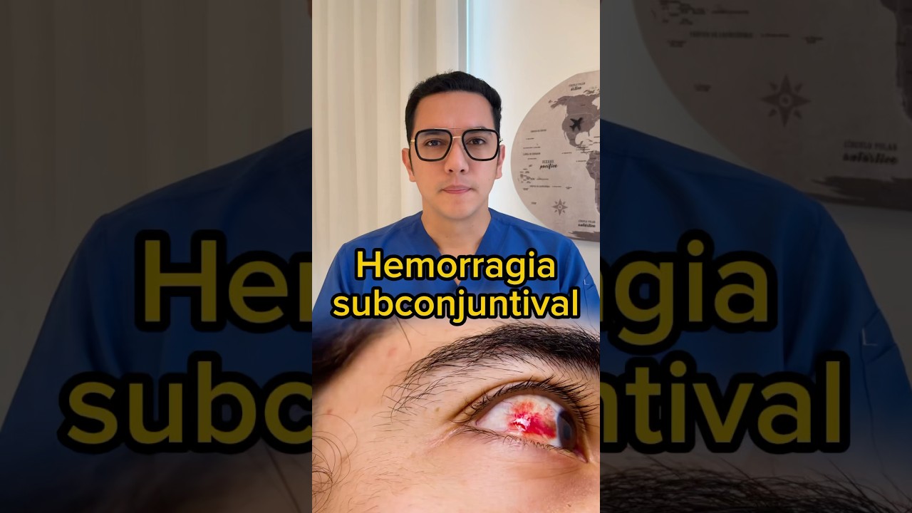 &iquest;Sufres hemorragia subconjuntival frecuente? Descubre la causa. #medicina #shorts #consejosdesalud