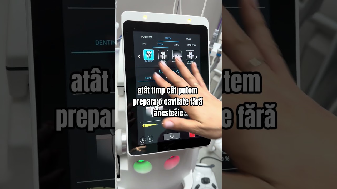 Tratamentul cariilor cu laser Erbium, fără durere, fără anestezie - Clinica Magic Smile