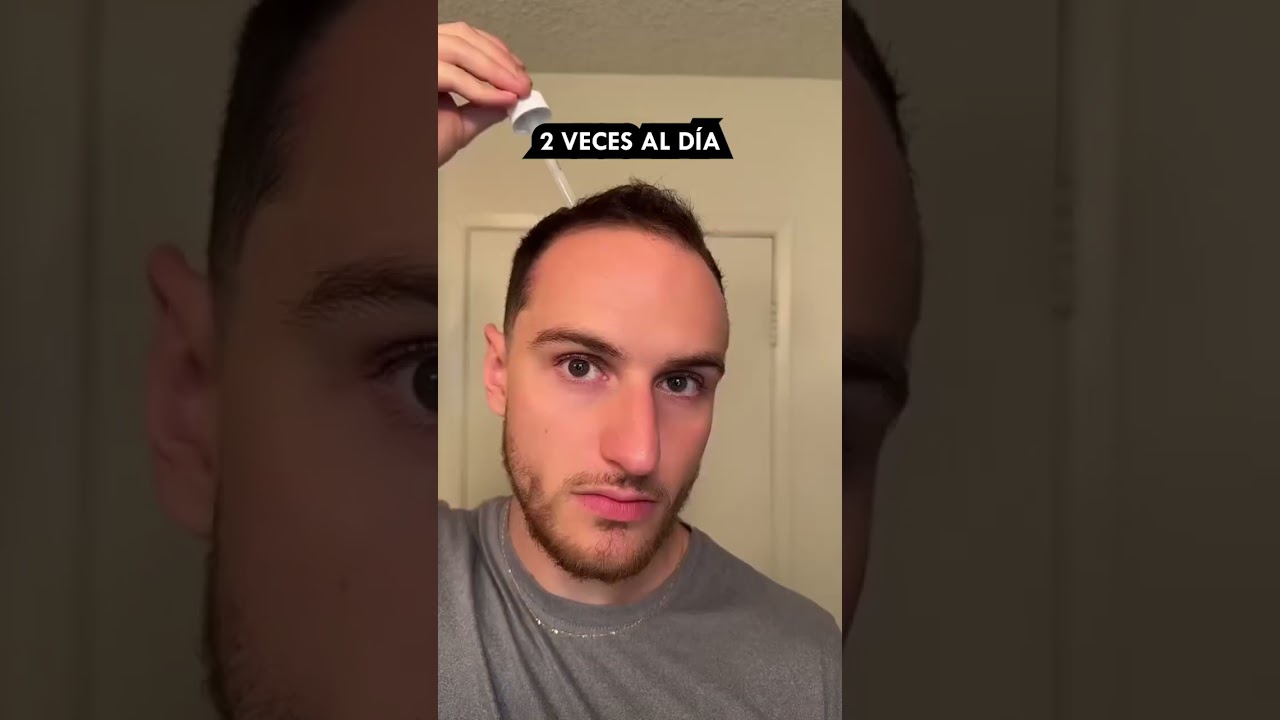C&oacute;mo Recuper&eacute; Mi Pelo En 8 Meses