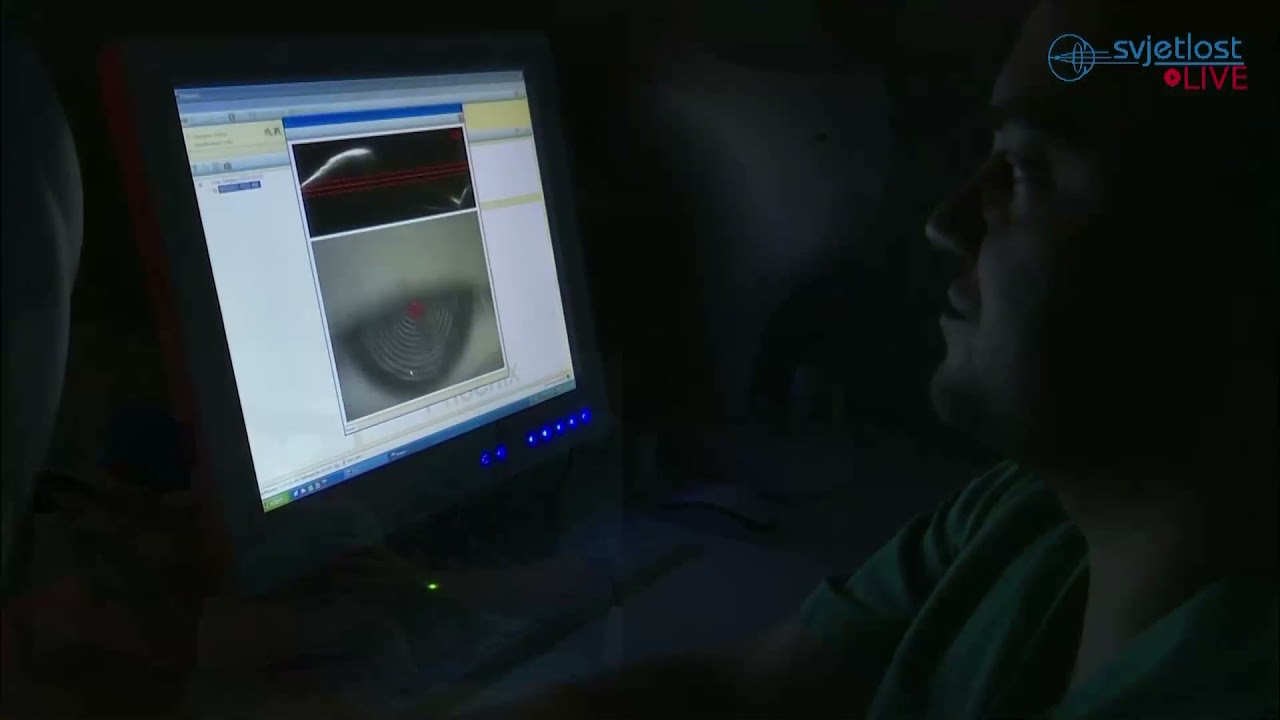 Happy surgeon during SCHWIND ATOS SmartSight live surgery