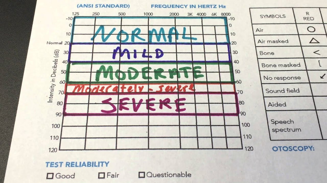 How to Read Your Audiogram