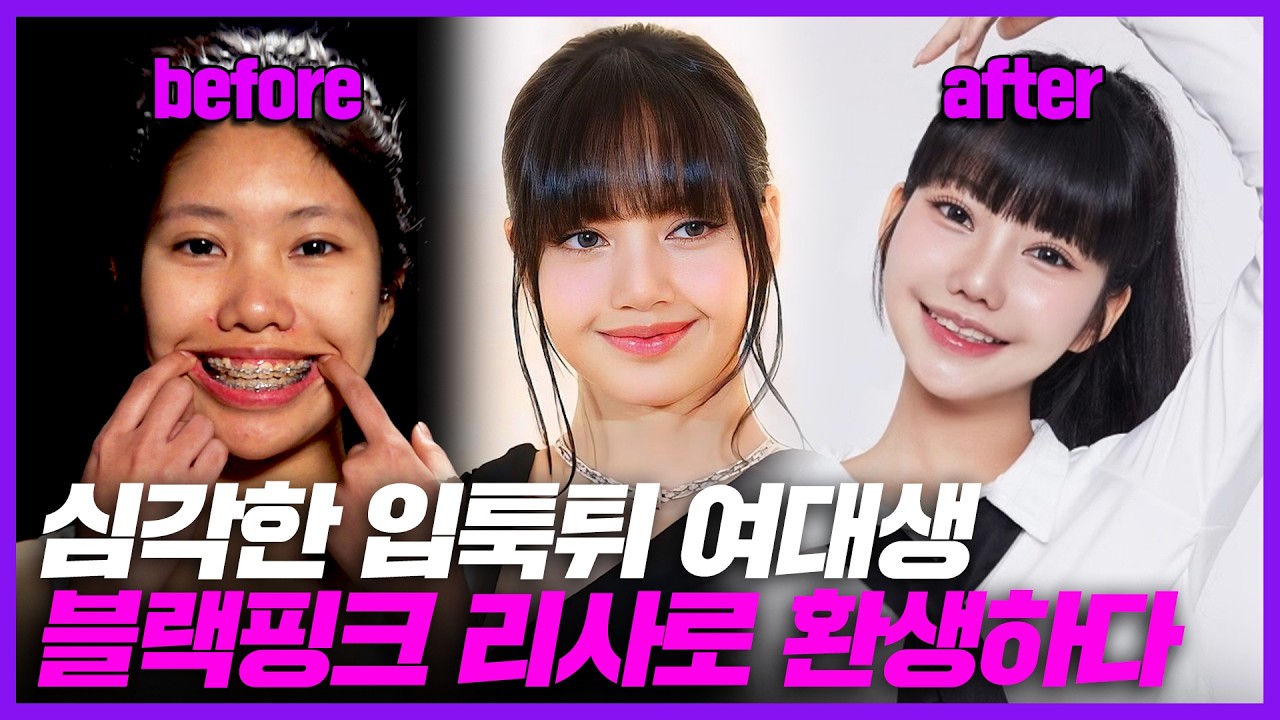 심각한 돌출입 여대생, 블랙핑크 리사로 환생하다!｜MAKE ME Girl