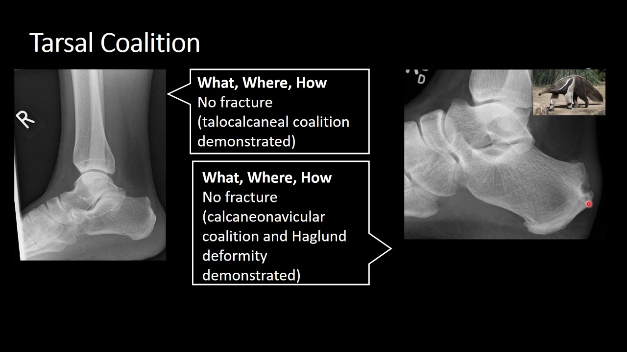 Anatomical Variants Part 2