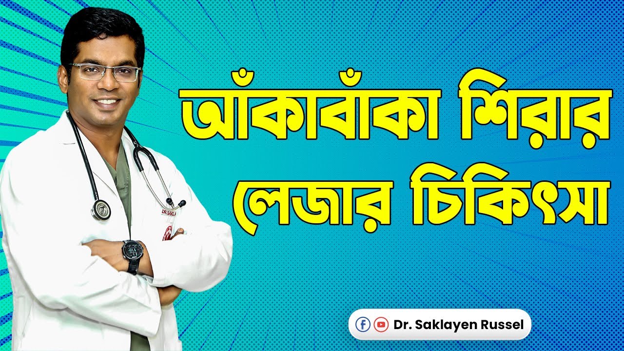 আঁকাবাঁকা শিরার লেজার চিকিৎসা। Dr. Saklayen Russel