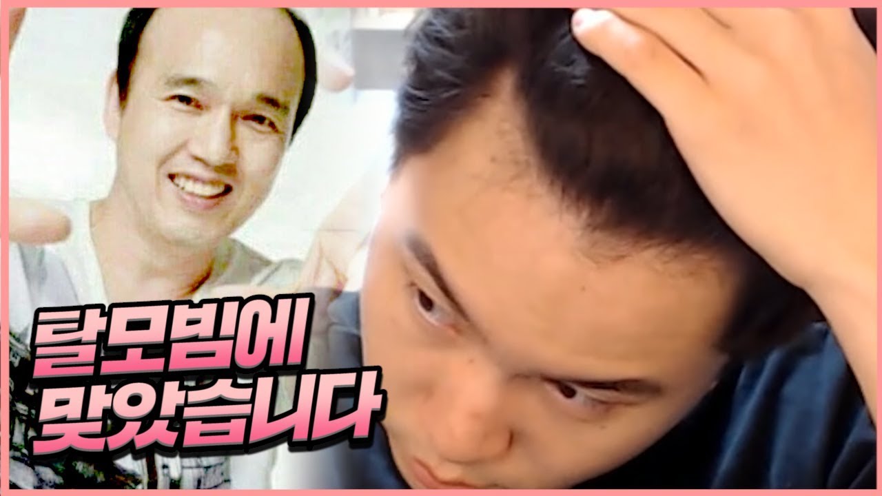 탈모빔에 맞아서 탈모르파티 참가합니다 ^^