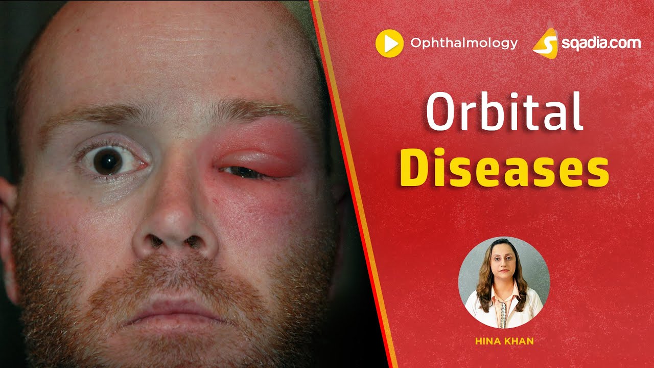 👁️ Orbital Diseases Masterclass | Essential Ophthalmology Training | V-Learning