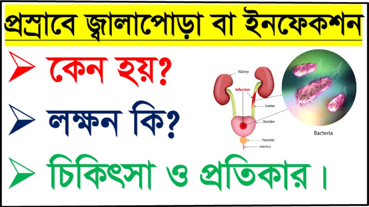 প্রস্রাবে ইনফেকশন হলে কি করনীয়? এর কারন, লক্ষন এবং ঘরোয়া চিকিৎসা কি? Urinary Tract infection (UTI)