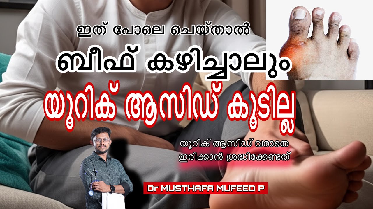 ബീഫ് കഴിച്ചാൽ ശരിക്കും യൂറിക് ആസിഡ് കൂടുമോ, does beef increases uric acide level,Dr Musthafa mufeed