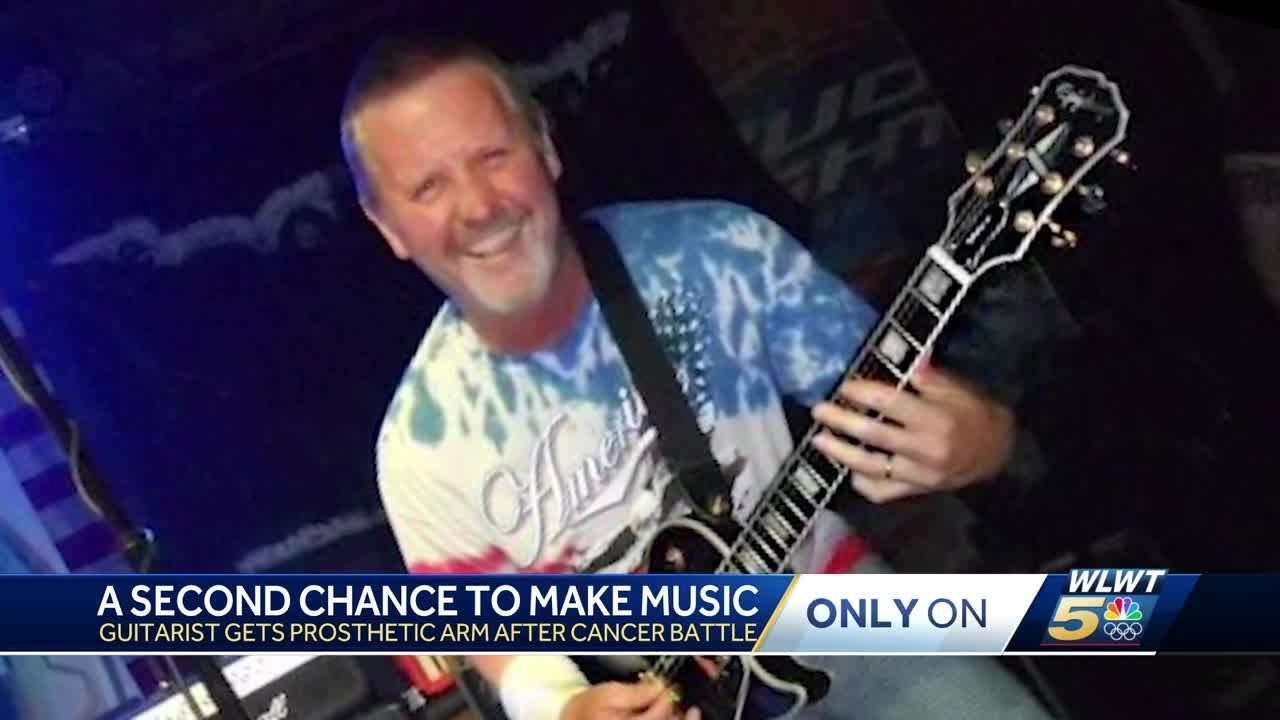 'Like I've never lost anything': Middletown guitarist gets prosthetic arm after cancer battle