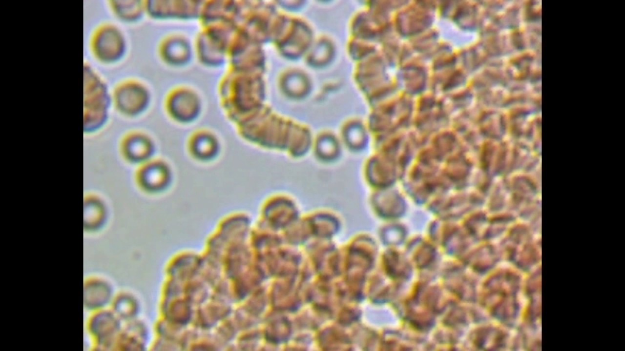 Trypanosomes in three different fresh blood preparations