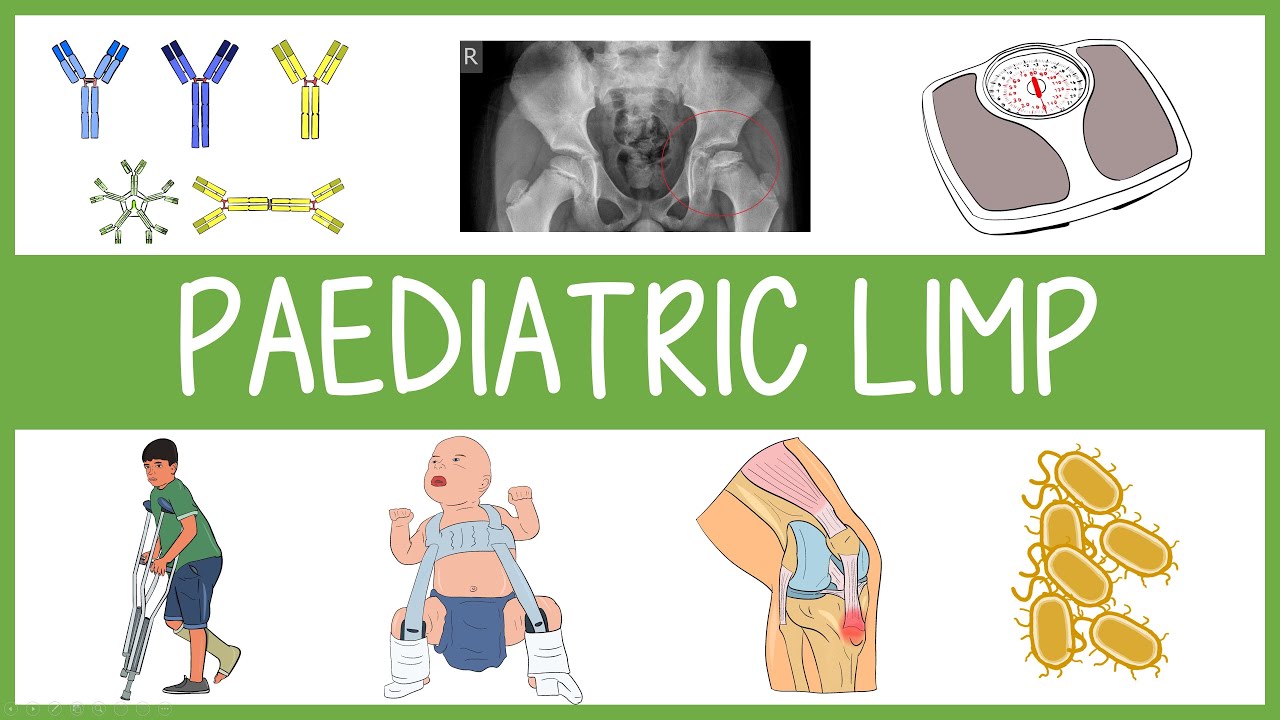 Paediatric Limp: Differential Frameworks