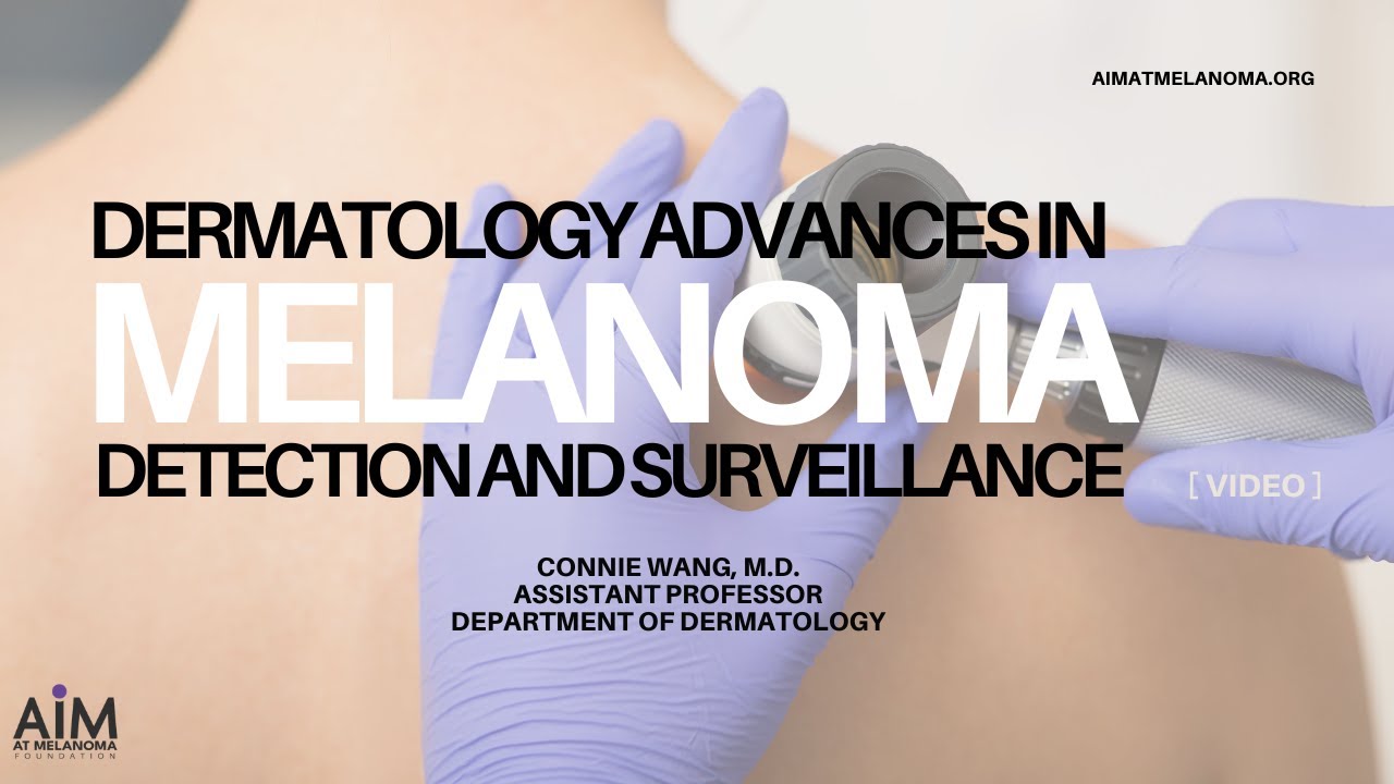 Dermatology Advances in Melanoma Detection and Surveillance