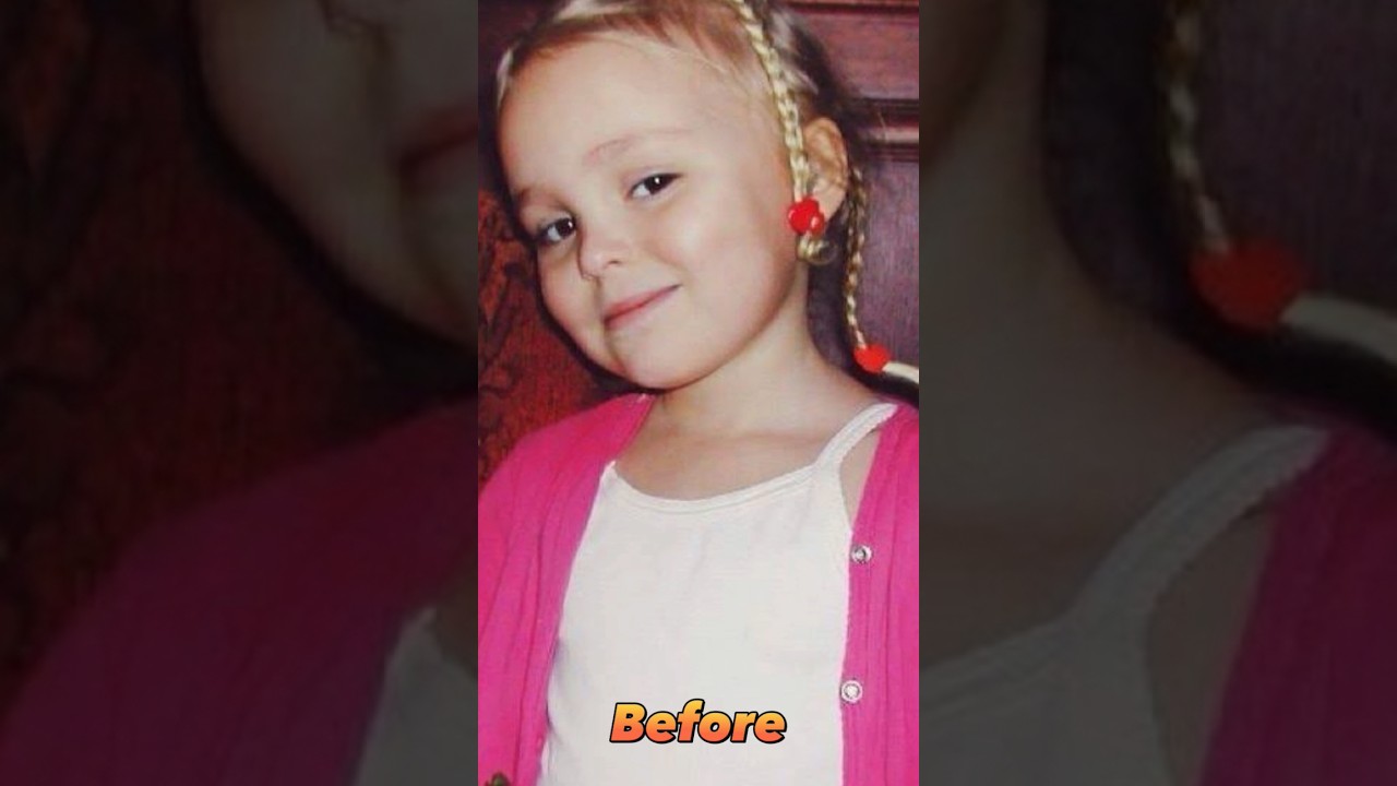 Lily Rose Depp Before After