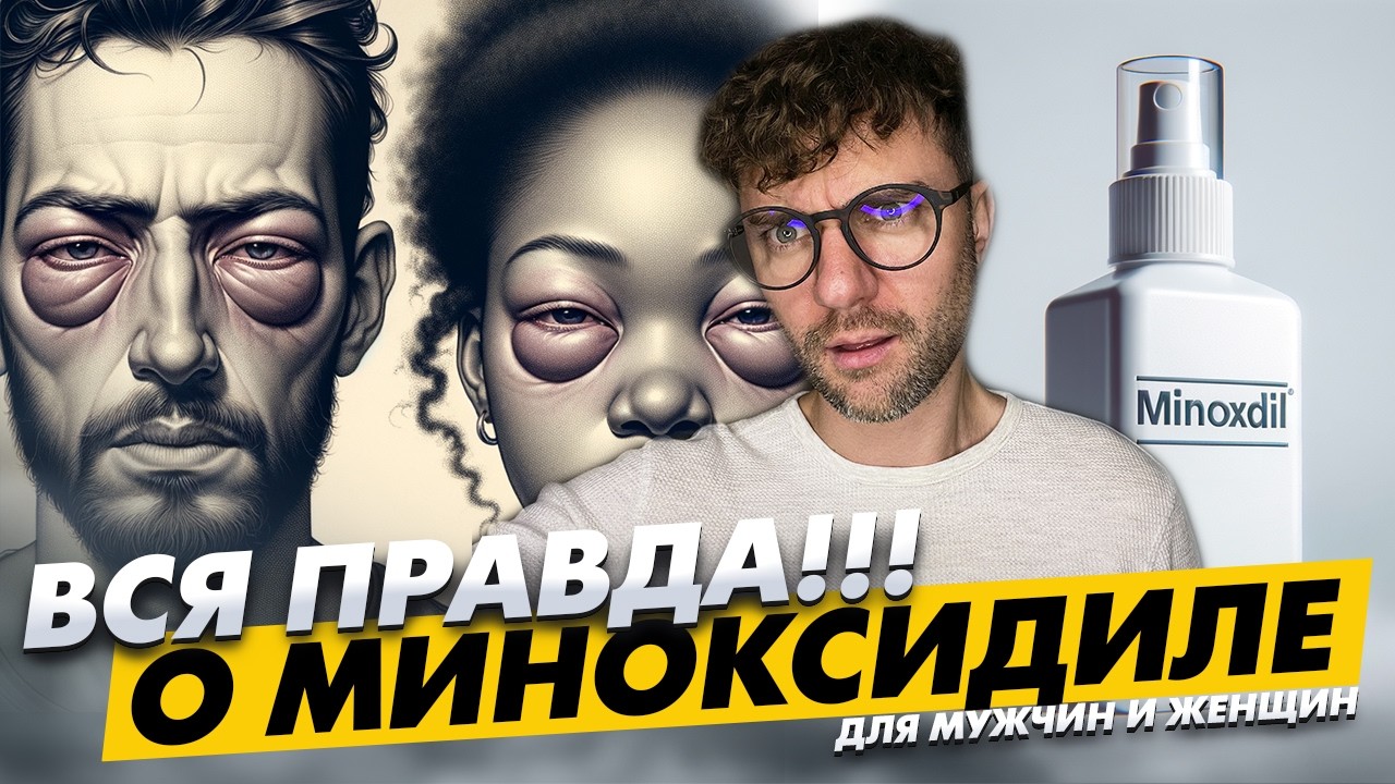ВСЯ ПРАВДА О МИНОКСИДИЛЕ ПРИ ПОТЕРЕ ВОЛОС ДЛЯ МУЖЧИН И ЖЕНЩИН \ KRASAV4IK
