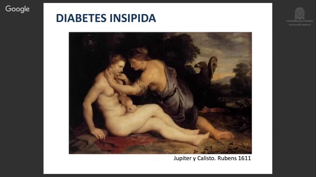 Diabetes insipida