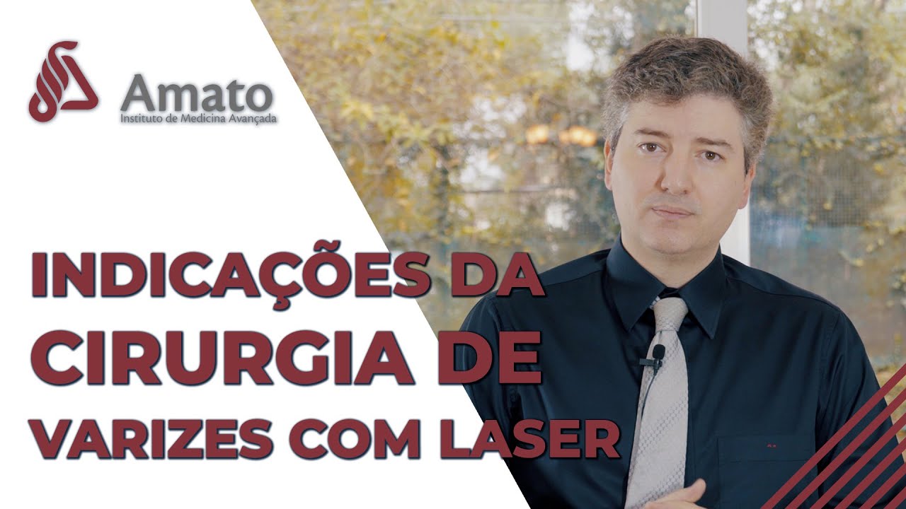 Quando fazer cirurgia de varizes com laser! sa&uacute;de para suas pernas!