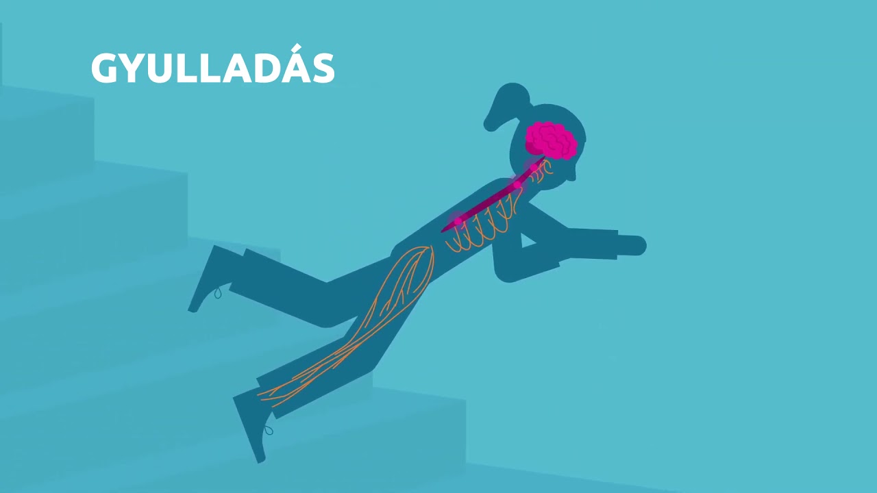 Hogyan hat a sclerosis multiplex az idegrendszerre?
