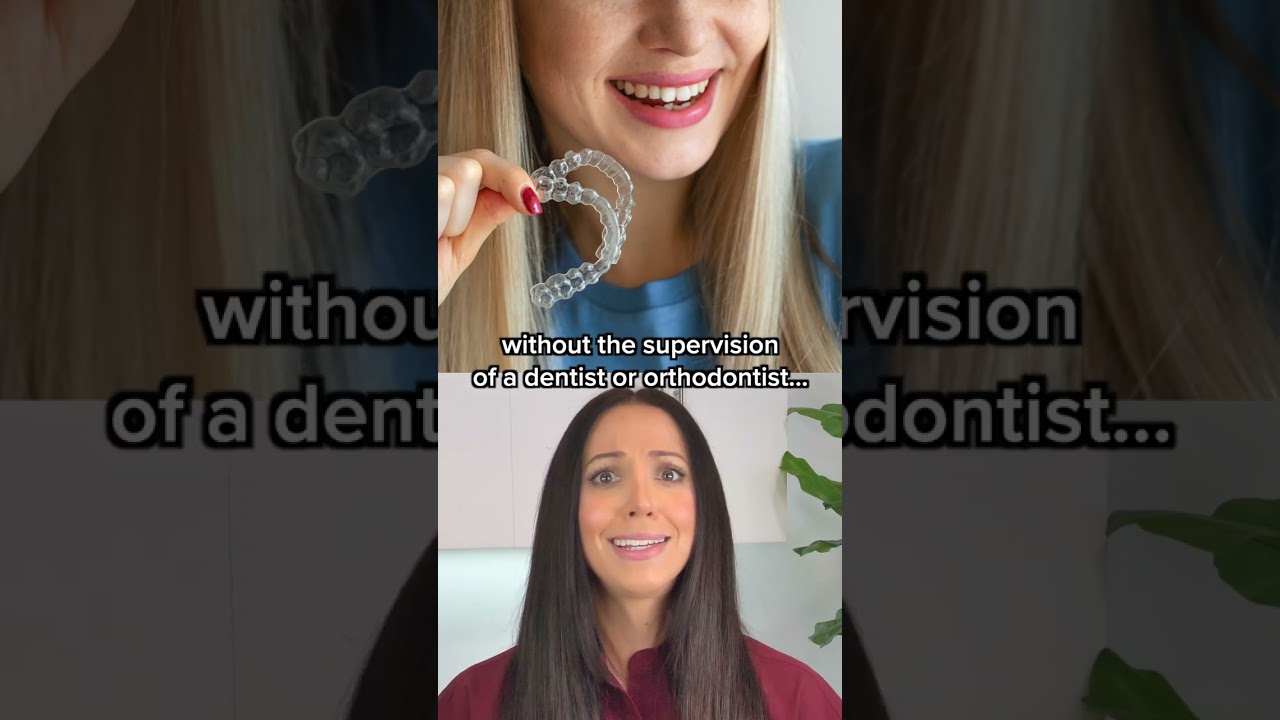 invisalign vs smile direct club teeth straightening #shorts