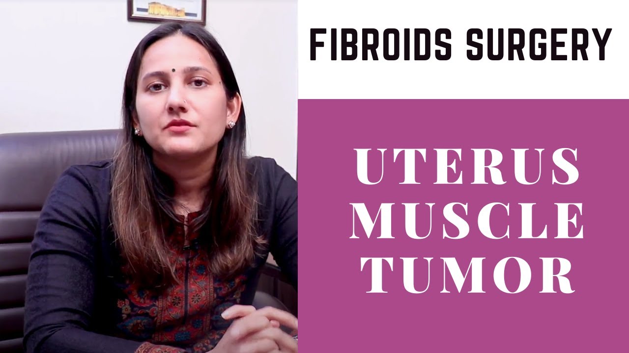 What are the types of Fibroids? | Fiberoid Surgical Treatment | Femi Nine