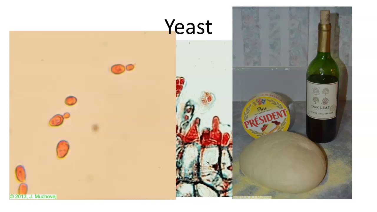 Ascomycota