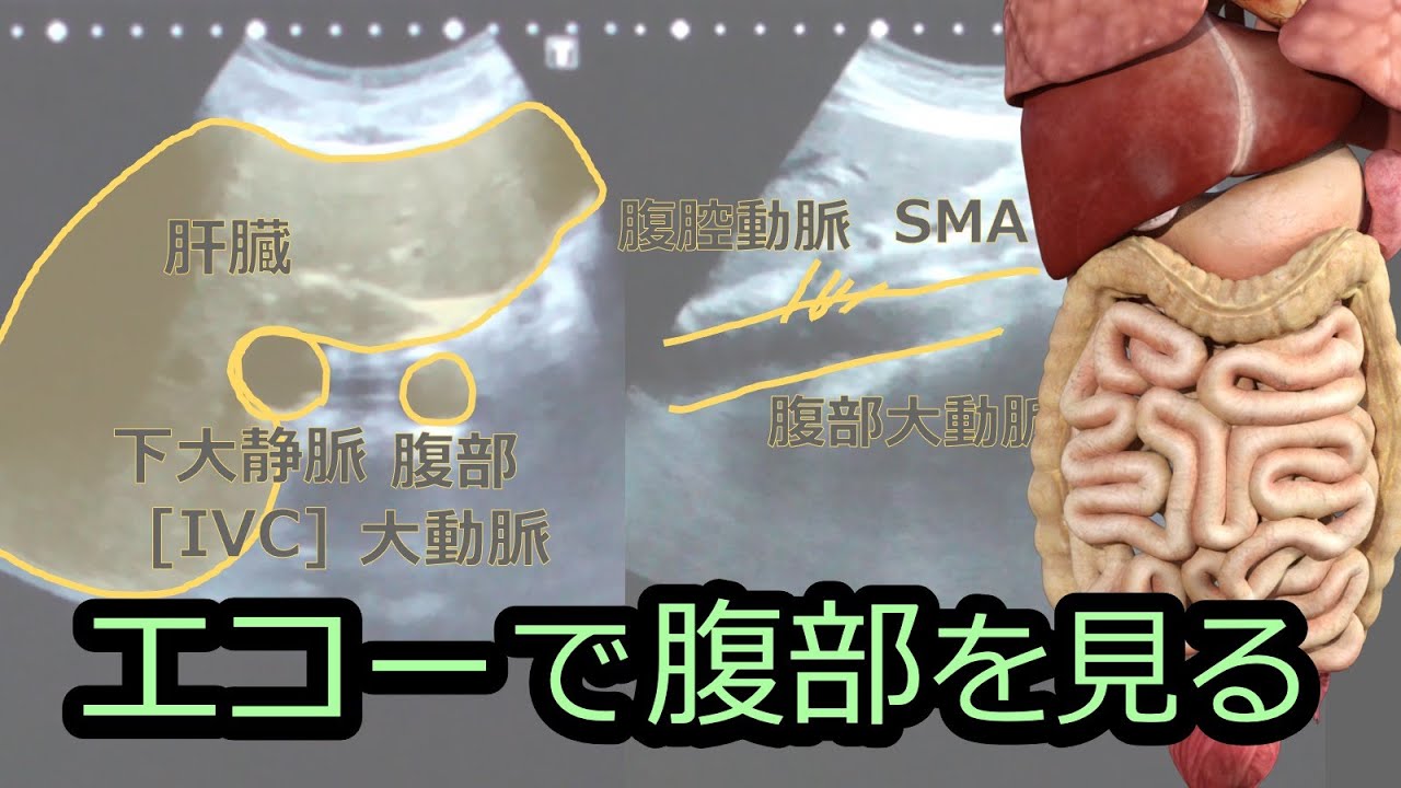 腹部エコーを見てみよう