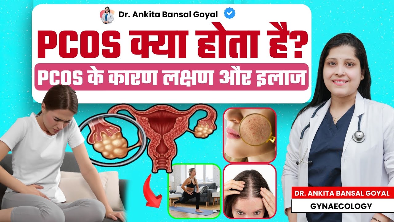 The SHOCKING Truth About PCOD Symptoms and Treatment | pcos ka ilaj in hindi