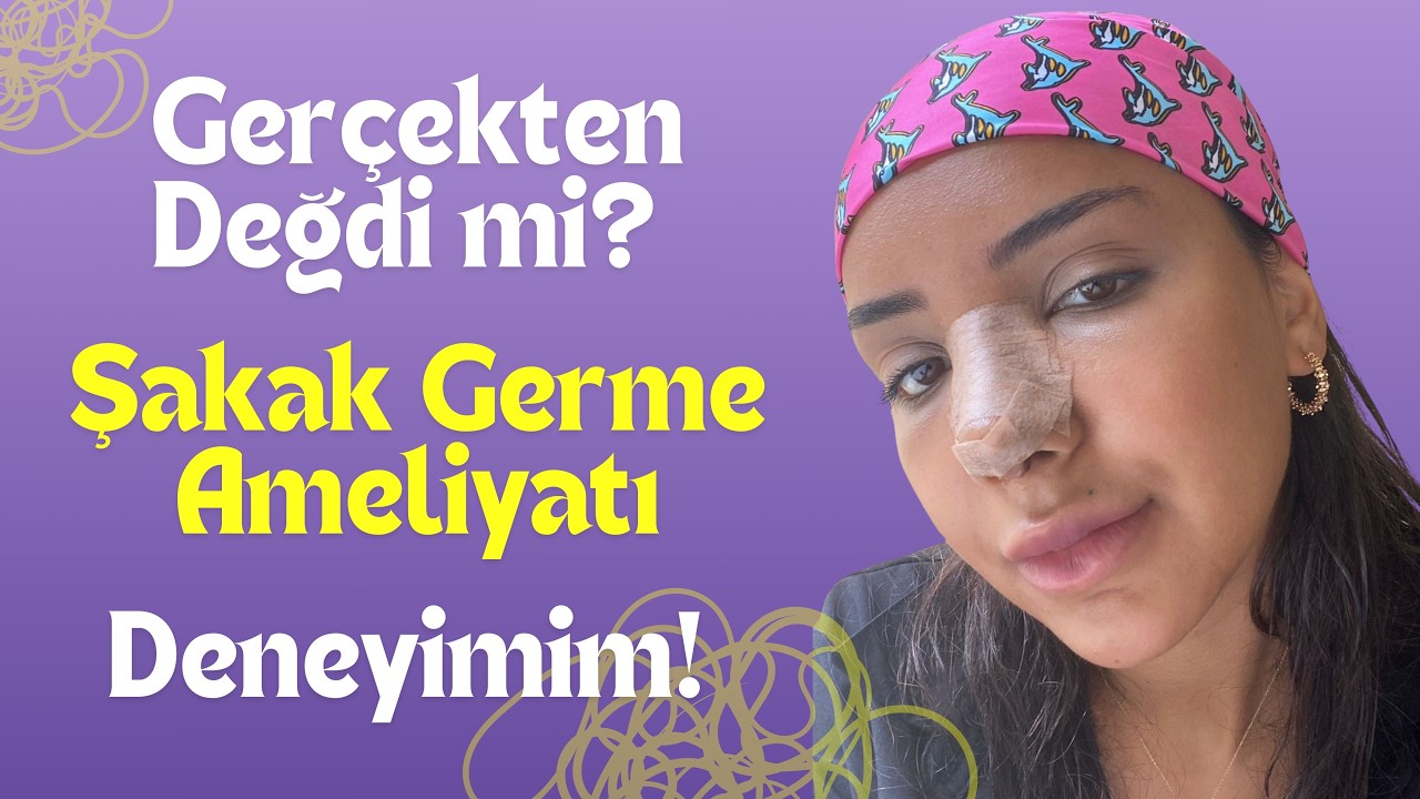 Şakak Germe (Temporal Lift) ve Burun Ameliyatı Sürecim | Pişmanlıklarım ve Etkileri 💉