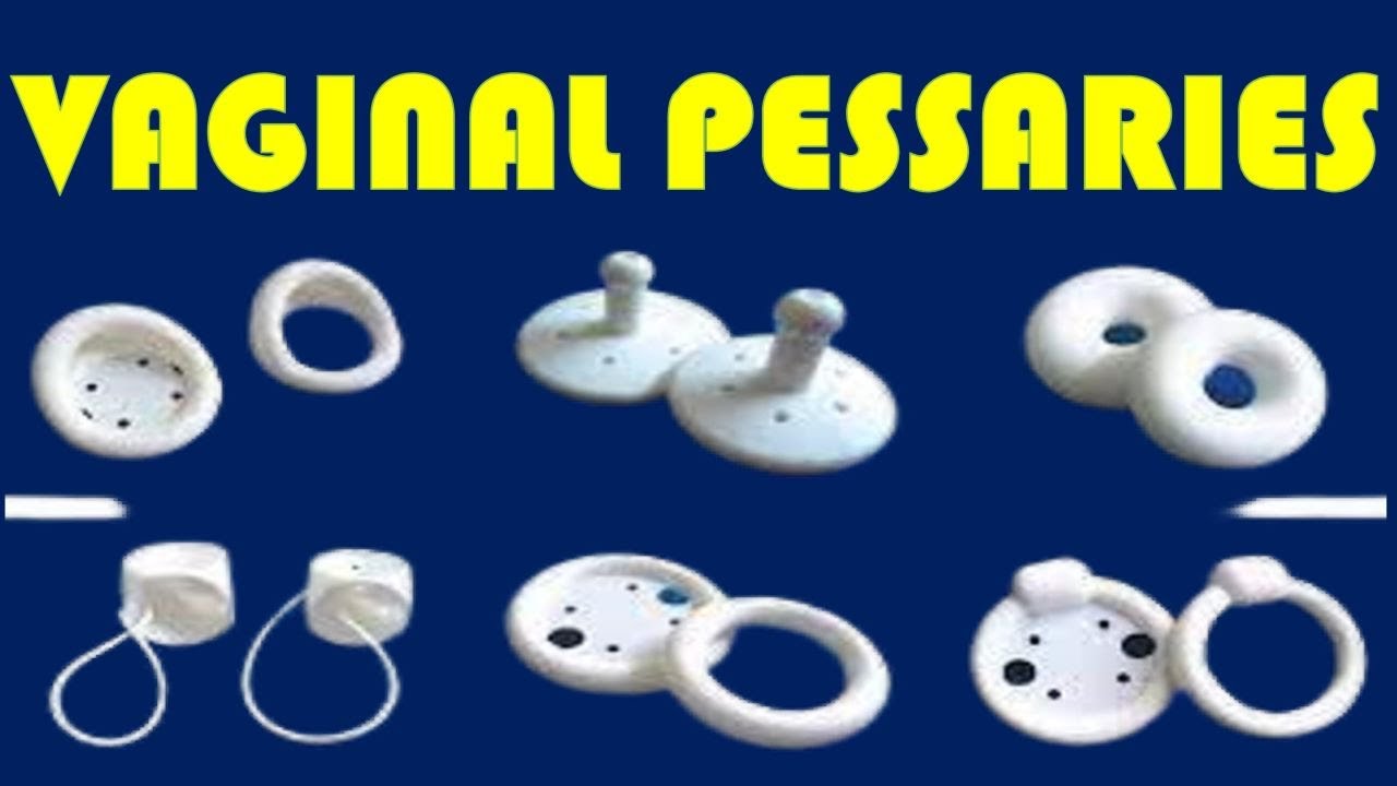 Uterine Prolapse and Incontinence Treatment | Types and Insertion Techniques of Pessaries