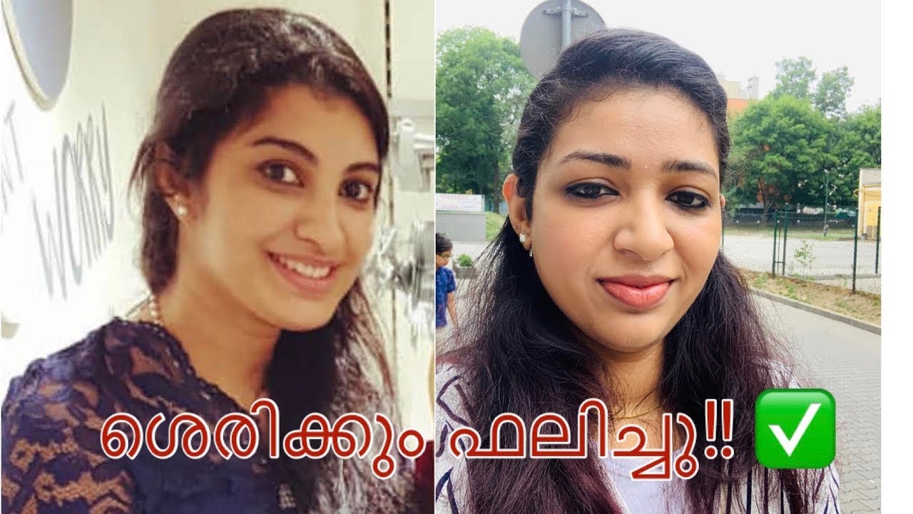 രോമവളർച്ച പൂർണമായും മാറ്റാം ||hair removal naturally at home