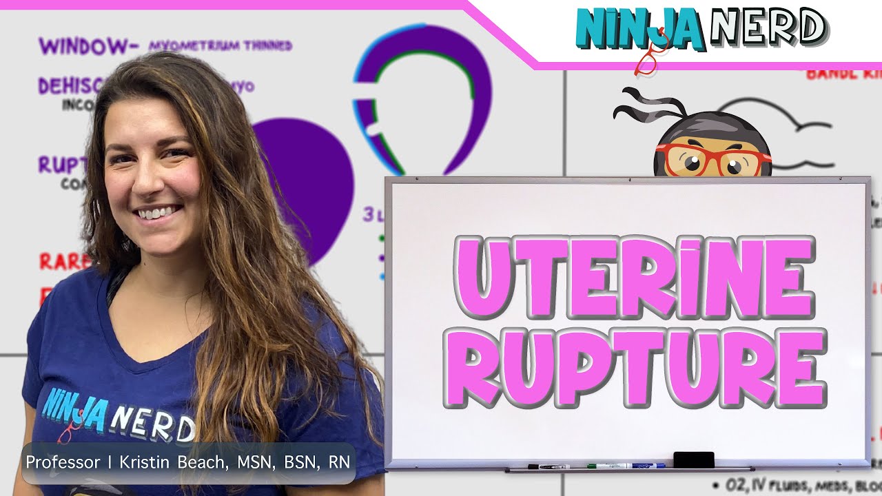 Uterine Rupture