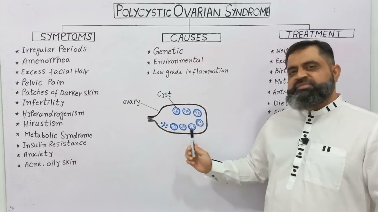 Polycystic Ovarian Syndrome Urdu/Hindi medium @Prof. Masood Fuzail| PCOS |