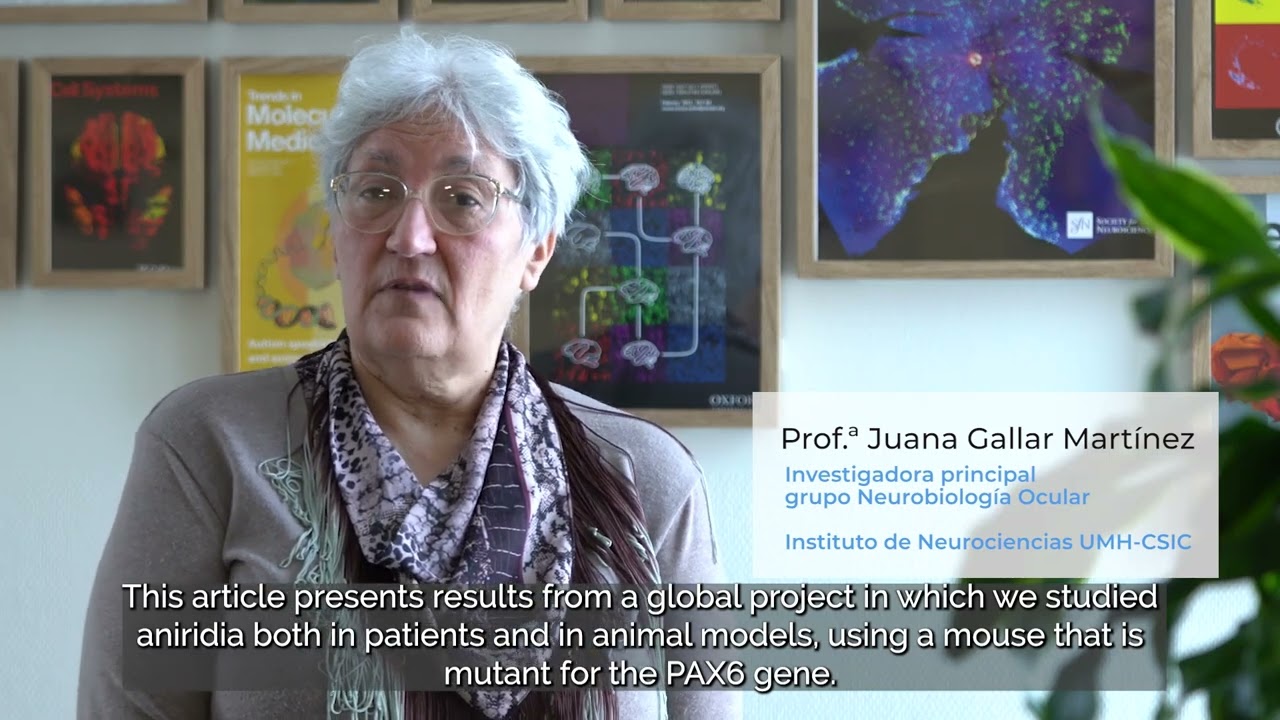 Un estudio revela que la aniridia provoca una pérdida progresiva de sensibilidad en la córnea