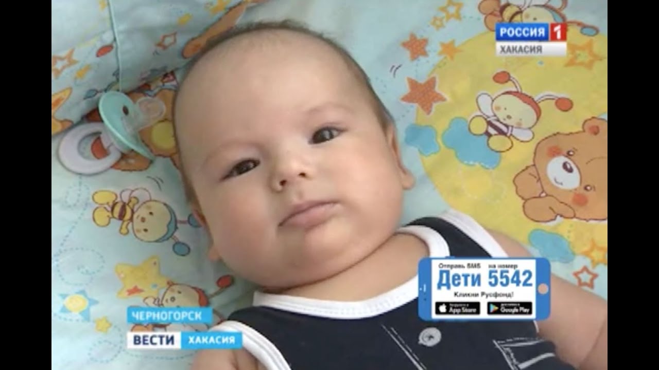 Саша Сарлин, 2 месяца, врожденная двусторонняя косолапость, требуется лечение по методу Понсети