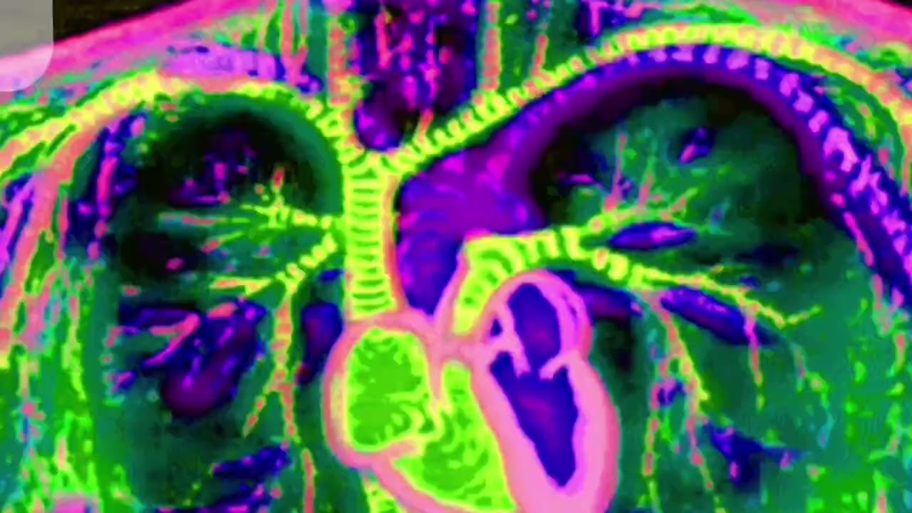 Trippshi