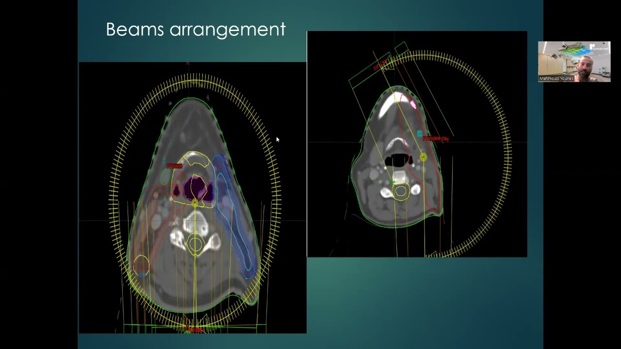 Plan Evaluation in Radiotherapy By Dr  Mahmoud Hosini