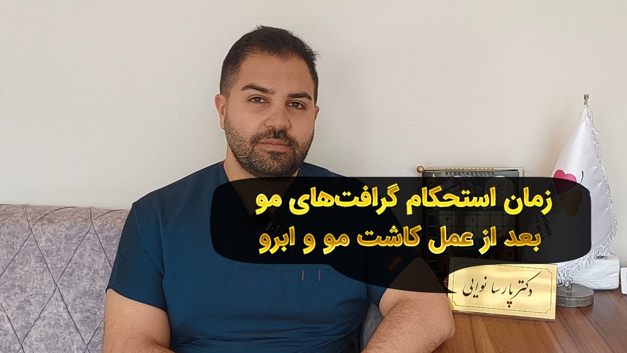 زمان استحکام گرافت های مو بعد از عمل کاشت مو و ابرو